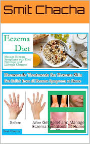 Ebook sur le Traitement Maison de l'Eczéma : Gérez vos Symptômes Naturellement