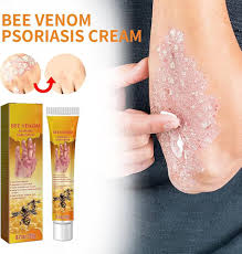 Traitement Professionnel UIRPK pour la Psoriasis - Crème Apaisante