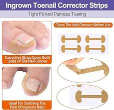 Correcteur DOrteils Coussinets Professionnels Redresseur - Soulagement pour Ongles Incarnés