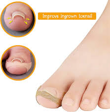 Autocollants Correction Traitement Paronychia - Soins pour Ongles Incarnés