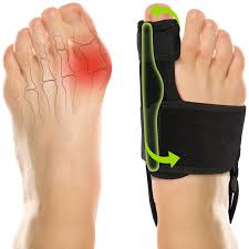 Correcteur Oignon Pour Femmes et Hommes - Soulagement Optimal