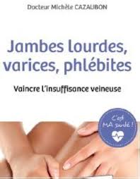 Soulagement des Jambes Lourdes avec Lourdes Varices