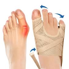 Attelle Hallux Valgus - Plantarelief Korrektor Femmes