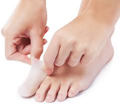 Pedimendtm Protecteur Blessures : Solution Idéale Contre le Frottement des Orteils