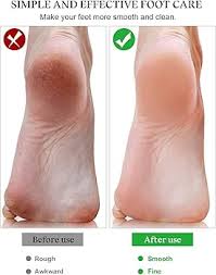 EBANKU Pédicure Fichier Remplacement – Prendre soin de vos pieds avec facilité