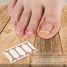 Autocollants Correction pour Ongles Incarnés - Traitement Efficace