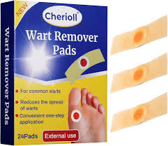 Traitement Efficace pour Verrues Plantaires