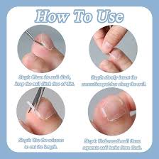 Correcteur Incarne pour Ongles Incarnés - Soulagement et Précision