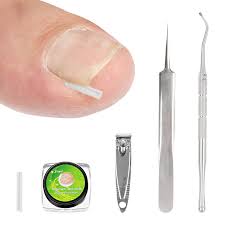 Incarnés Traitement Correction Remplissage Inoxydable - Solution Efficace pour Ongles Incarnés