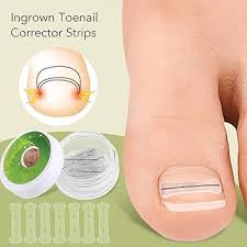 Correctrices Élasticité pour Ongles Incarnés - Soulagement et Protection