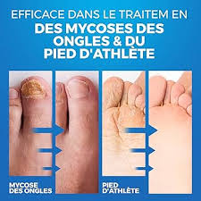 Désinfectant pour Chaussures et Chaussettes Imperial Feet - Prévenez les Mycoses