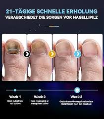 Traitement Mycose Pied - Solución Eficaz pour Vos Pieds