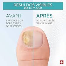 PODERM Exceptionnelles Purifiantes Réparatrices Professionnel - Soin Complet pour Mycose du Pied