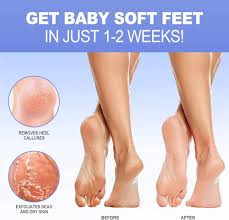 Exfoliant Laitique JVR pour le Soin des Pieds