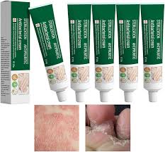 Crème Antifongique pour Éliminer les Champignons des Ongles